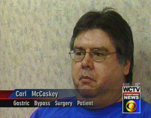Carl before he had gastric bypass surgery